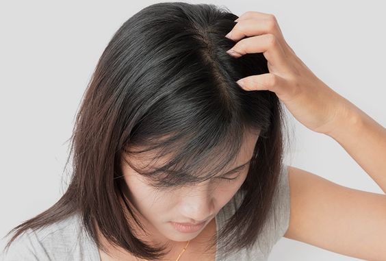What Causes Dry Scalp and Dandruff, How do you get rid of dry scalp, why do I have dry scalp and dandruff, what causes dandruff and dry itchy scalp, is dandruff a sign of dry scalp, what is dry scalp and dandruff, why is my scalp so dry with dandruff, what can i do for dry scalp and dandruff, what can help with dry scalp and dandruff, how to get rid of dry scalp and dandruff naturally, why is there dandruff on my scalp, why do i get dandruff on my scalp, how to treat dry scalp, what causes dandruff, dandruff vs dry scalp, dry scalp treatment at home,